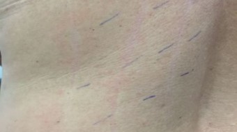 12/05/2017 Ação Barras (PI)