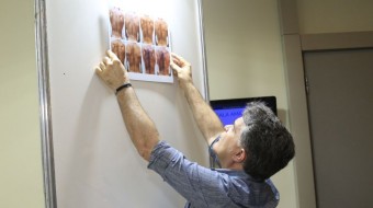 Médico cria exposição artística com fotografias de manchas na pele por hanseníase