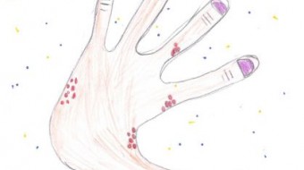 Alunos de 5ª série criam desenhos para a campanha nacional Todos contra a Hanseníase
