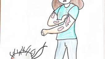 Campanha nacional Todos contra a Hanseníase - Foz do Iguaçu