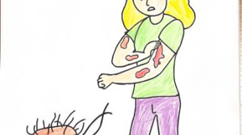 Campanha nacional Todos contra a Hanseníase - Foz do Iguaçu